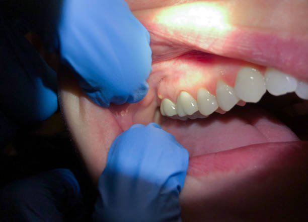 Best Same-Day Emergency Dental Services in Kingstowne, VA
