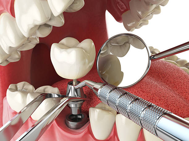Best 24-Hour Emergency Dentist in Kingstowne, VA